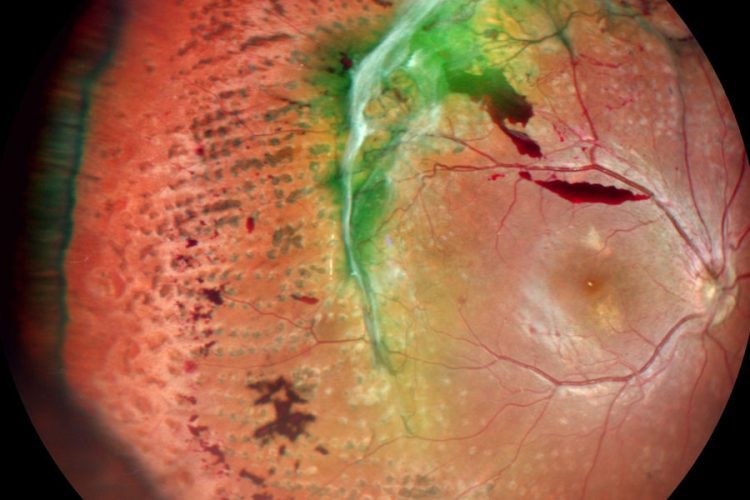 NIDEK anuncia a los ganadores del 4º Premio Anual a la Imagen del Año