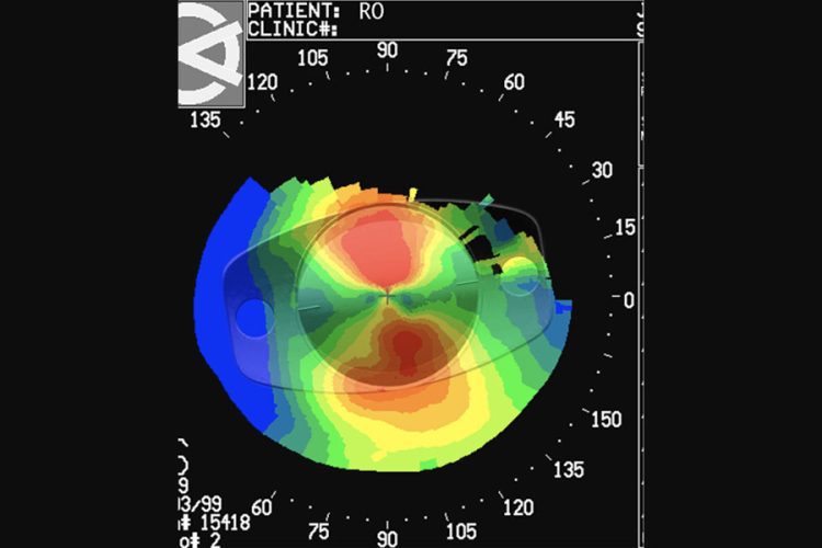 Asegurar la felicidad premium del paciente
