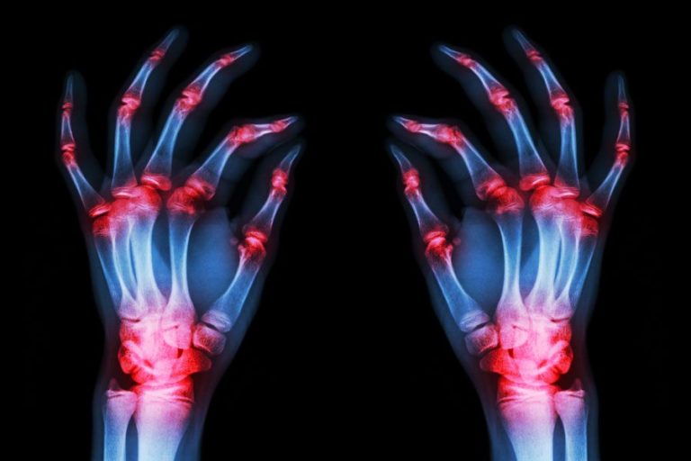 Pagina Nota5 100424 Oald 768x512