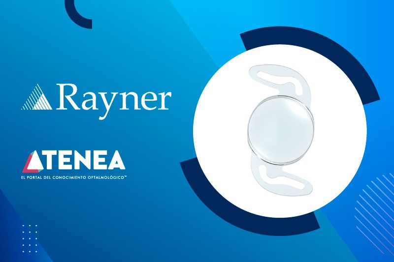 rayner 800x533