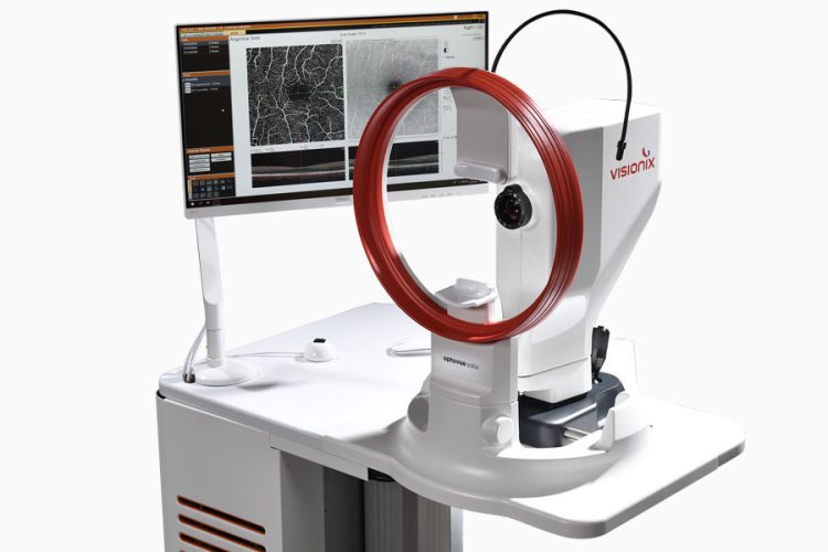 Conoce las características de Optovue Solix