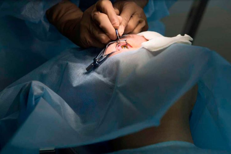 ¿Es bueno su nomograma?