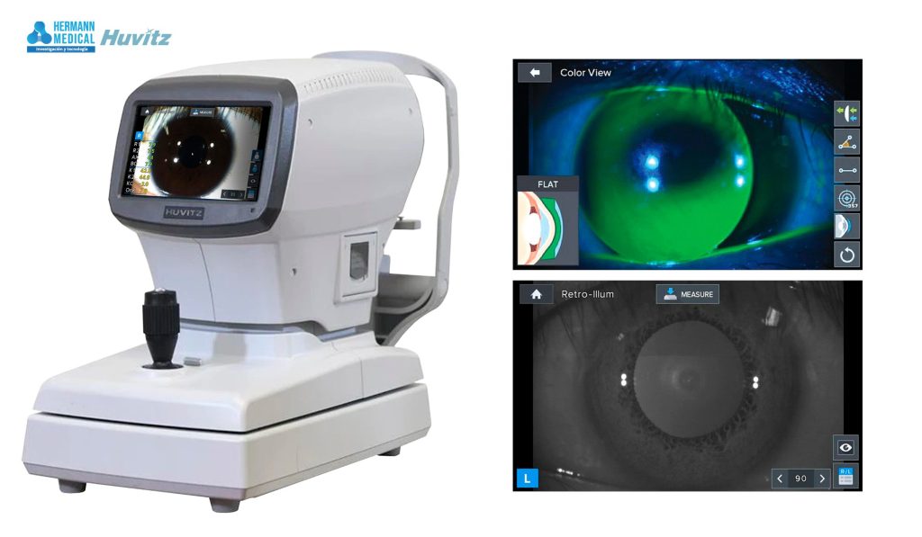 Hermann Medical Presenta el Auto Refractómetro Queratómetro HRK-1 HRK 2 02 03 1 Copia 1024x597