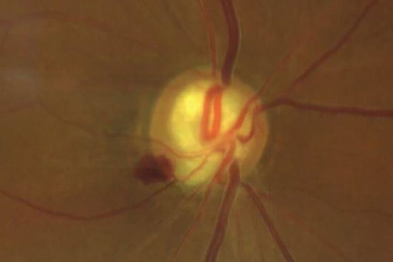 Pagina Nota5 091024 Oald 768x512