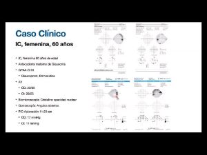 12galeria Nota4 161024 Oald 300x225