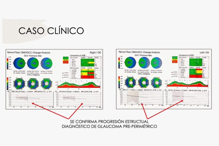 Pagina Nota3 161024 Oald 768x512