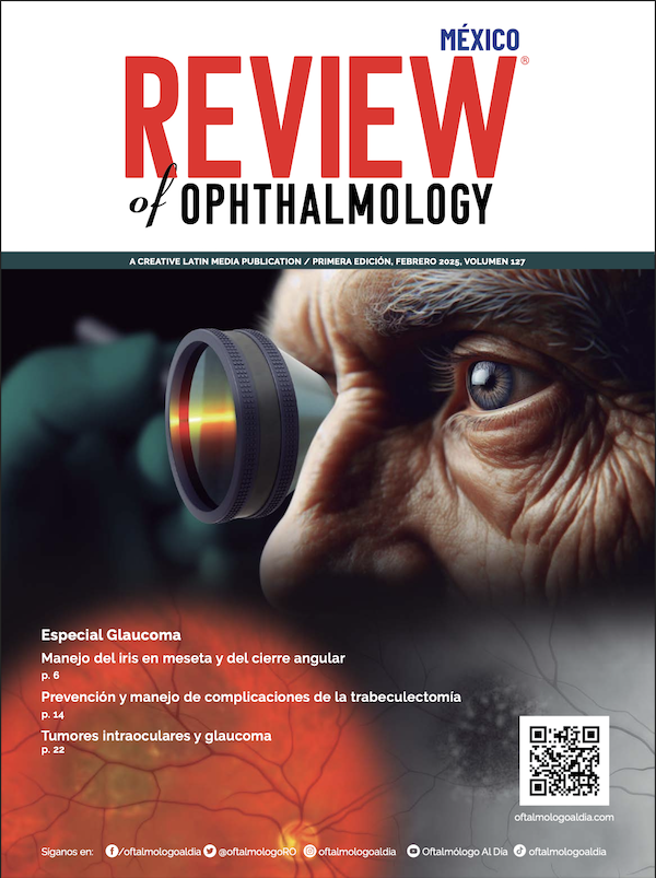 Portada RO Ed 1 11 25 Vol 127 Mx 01