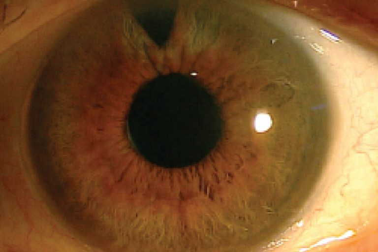 Pagina Nota4 080525 Oald 768x512