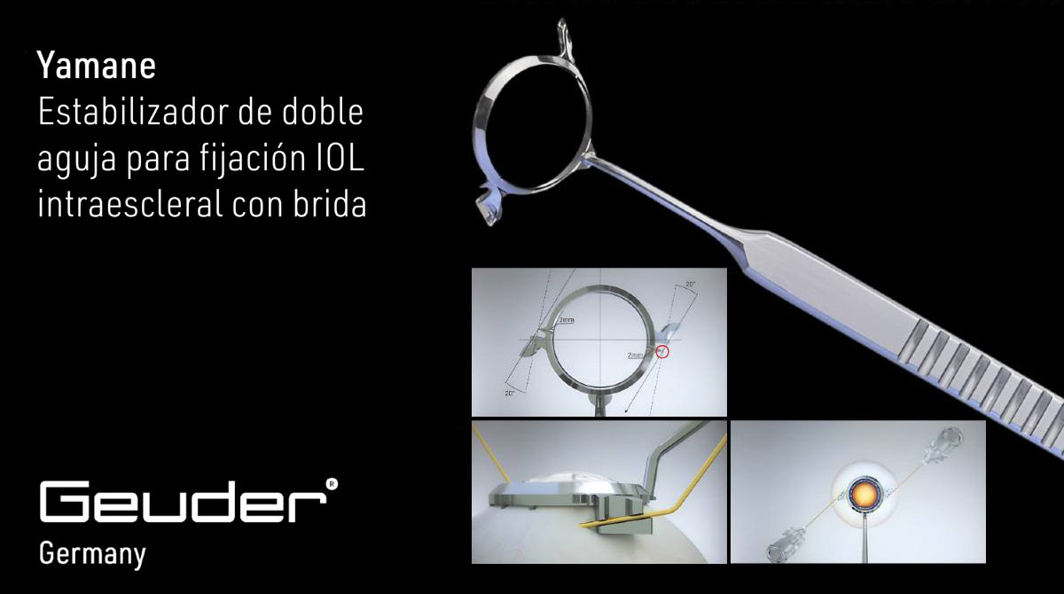 Pagina Nota5 300425 Oald