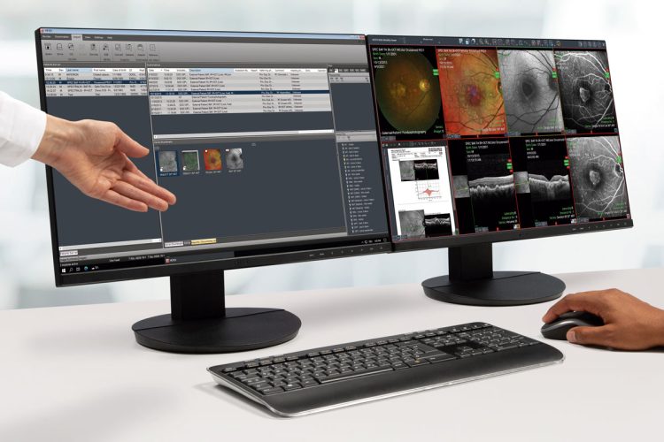 HEYEX 2: Diseñado para el futuro del cuidado de la visión