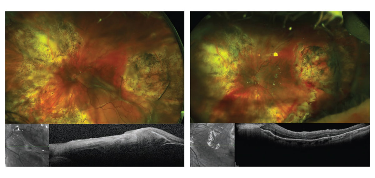 Pagina Nota3 020725 Oald