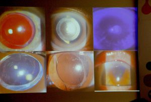 05alcon Nota2 210825 Oald 300x204