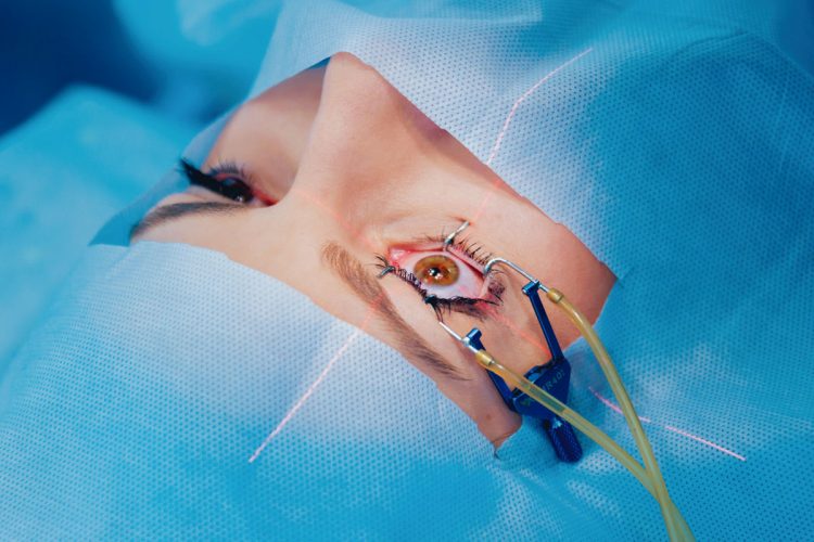 Riesgos retinianos en la miopía y la cirugía LASIK
