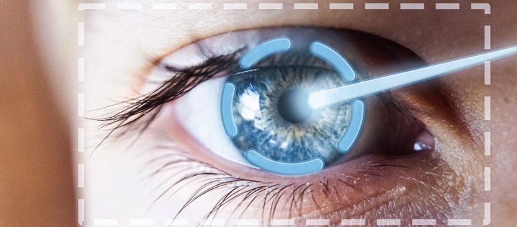 Glaucoma secundario a cirugía vítreorretinal con aceite de silicón