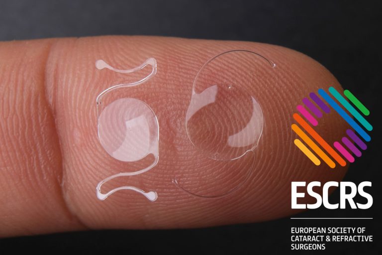 Lentes intraoculares de nueva generación mejoran la independencia visual Pagina Nota4 081025 Oald 768x512