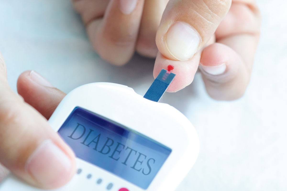 La diabetes podría reducir el efecto de la terapia anti-VEGF en la DMAE