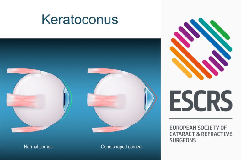 pagina nota3 031225 oald