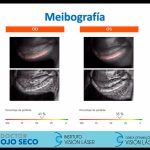 Ojo seco, ¿Qué debo saber este 2026? 09galeria nota4 110226 oald