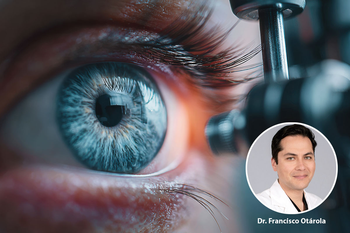 ¿Cuándo y cómo hacer cirugía combinada de cataratas y glaucoma?