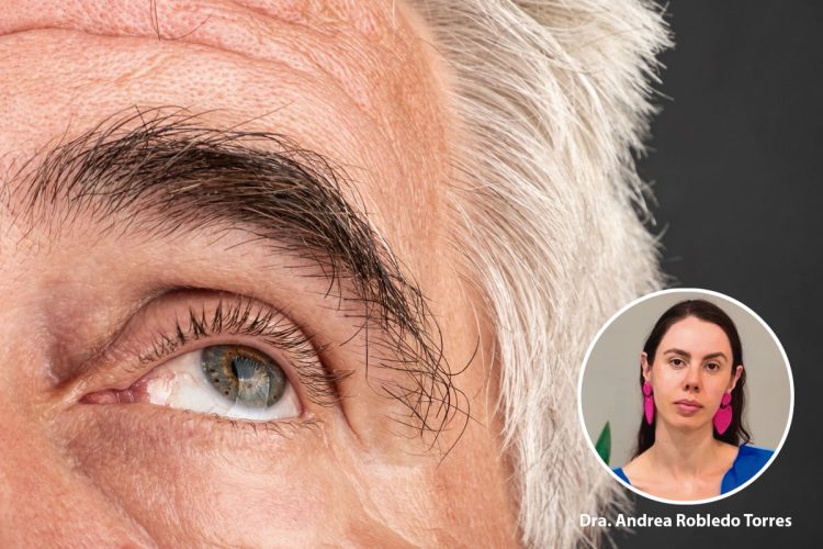 Eficacia de Latanoprosteno Bunod como Monoterapia Inicial en Glaucoma Secundario a Pseudoexfoliación