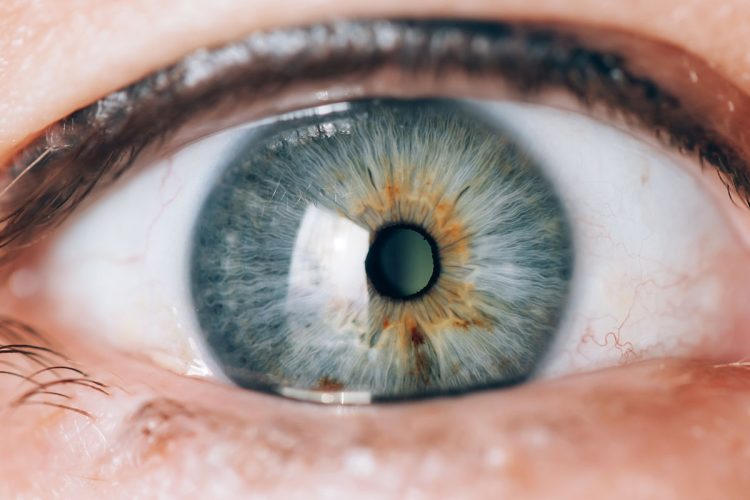 ¿Pueden los pacientes con glaucoma recibir lentes intraoculares premium?