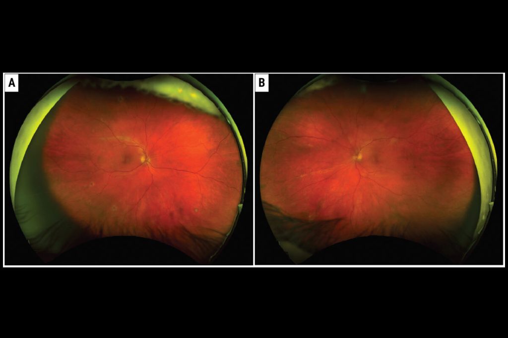 pagina nota4 180226 oald (1)