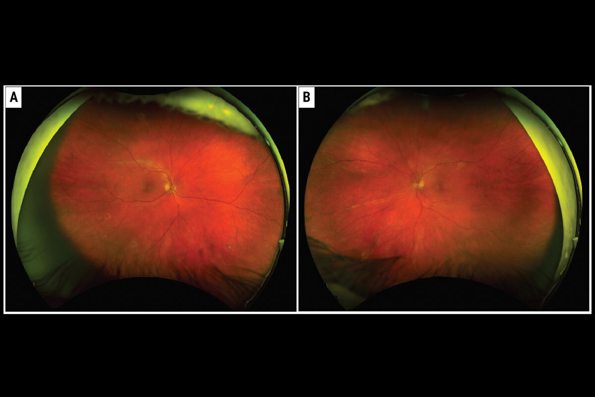 pagina nota4 180226 oald (1)